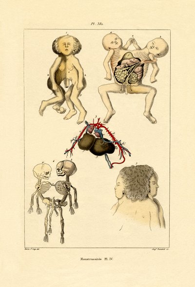 Freak von French School